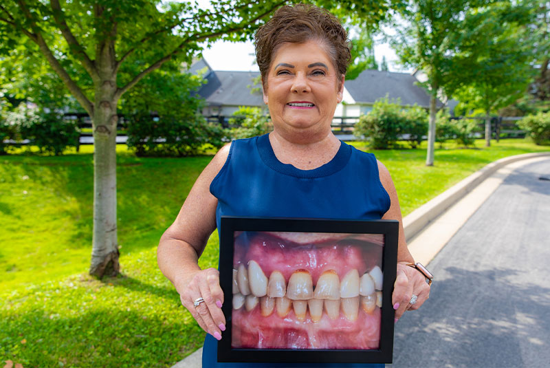 Tammy - dental implants patient