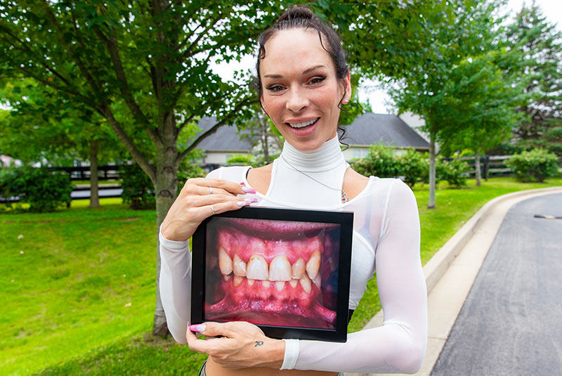 dental implant patient smiling